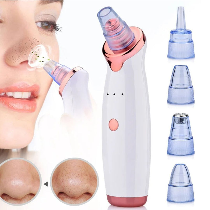 VioxaClear™ – Succionador de Poros Profesional | Limpieza profunda para una piel impecable